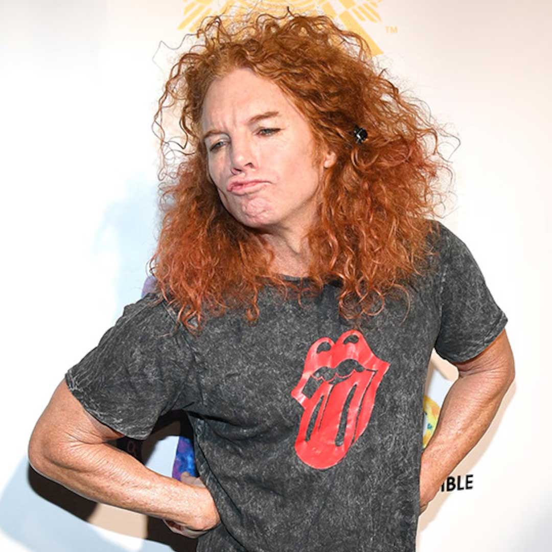 Carrot Top